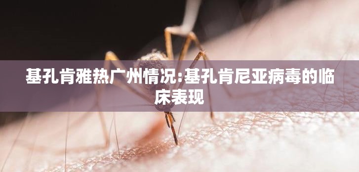 基孔肯雅热广州情况:基孔肯尼亚病毒的临床表现