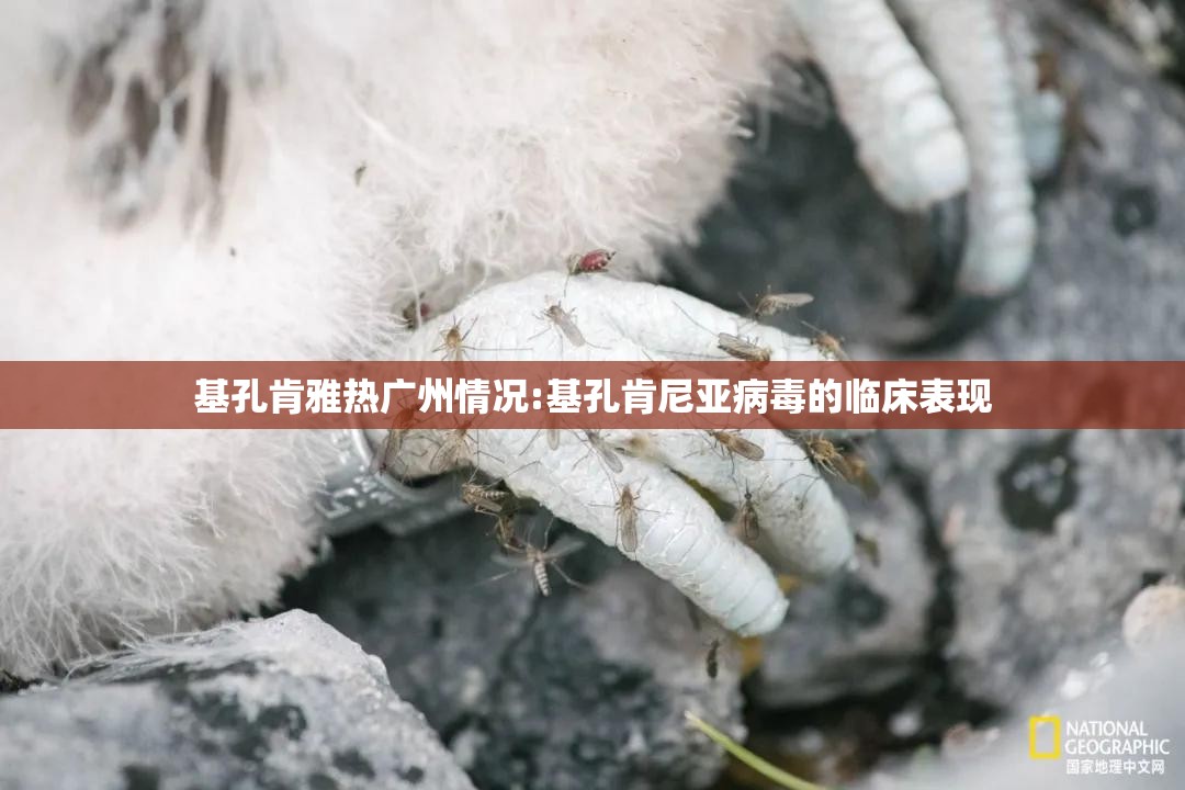 基孔肯雅热广州情况:基孔肯尼亚病毒的临床表现