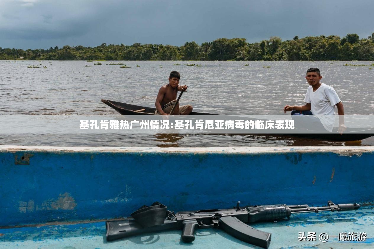 基孔肯雅热广州情况:基孔肯尼亚病毒的临床表现