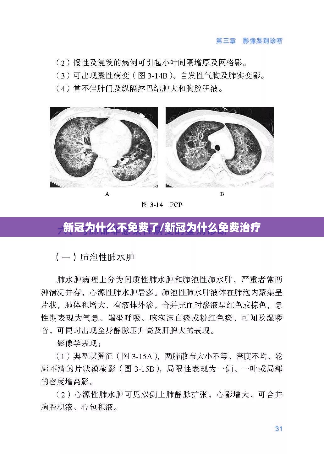 新冠为什么不免费了/新冠为什么免费治疗