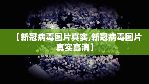 【新冠病毒图片真实,新冠病毒图片真实高清】