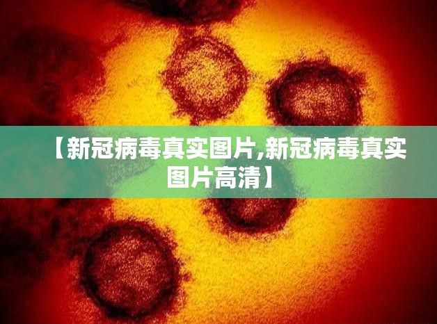 【新冠病毒真实图片,新冠病毒真实图片高清】