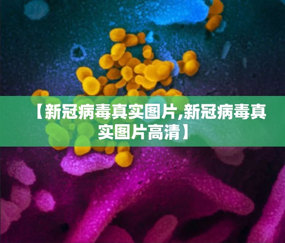 【新冠病毒真实图片,新冠病毒真实图片高清】