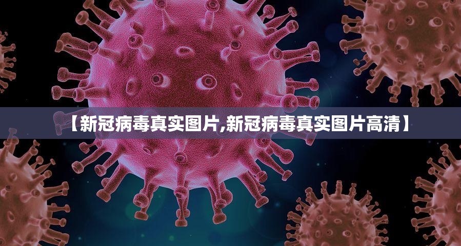 【新冠病毒真实图片,新冠病毒真实图片高清】
