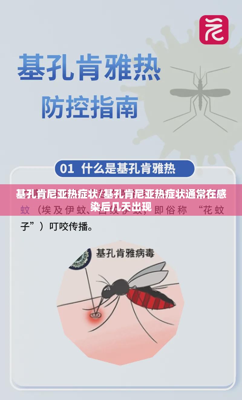 基孔肯尼亚热症状/基孔肯尼亚热症状通常在感染后几天出现