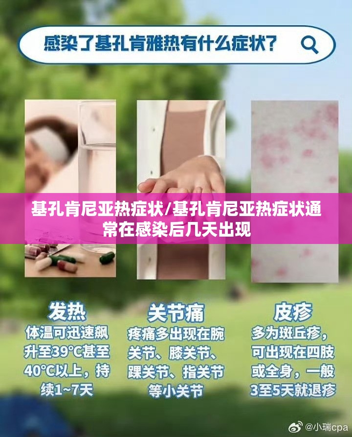 基孔肯尼亚热症状/基孔肯尼亚热症状通常在感染后几天出现