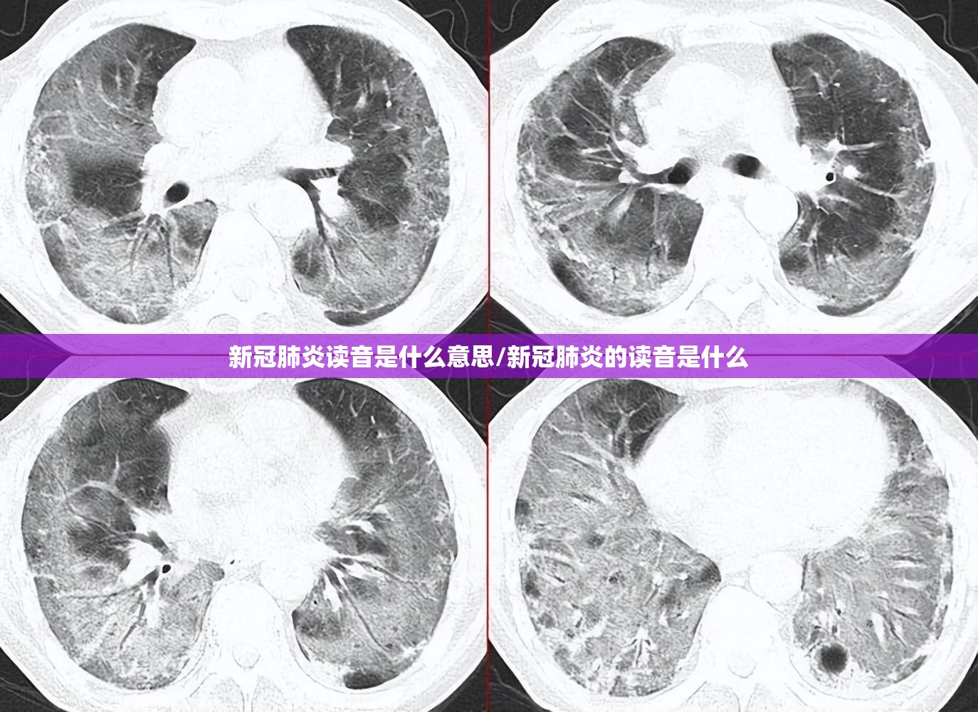 新冠肺炎读音是什么意思/新冠肺炎的读音是什么