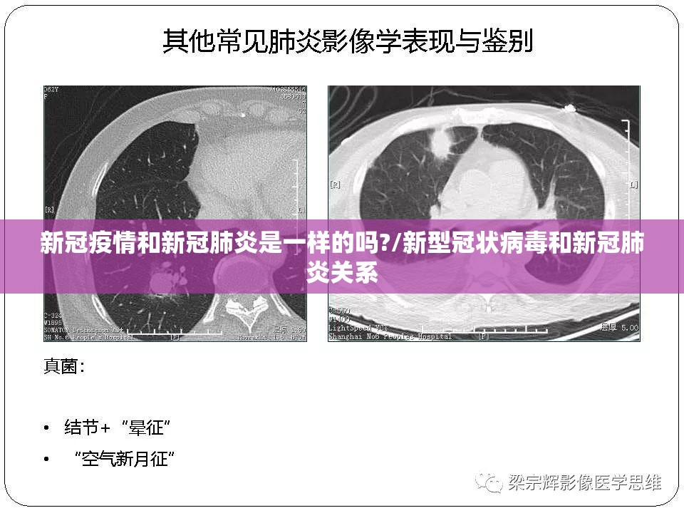 新冠疫情和新冠肺炎是一样的吗?/新型冠状病毒和新冠肺炎关系