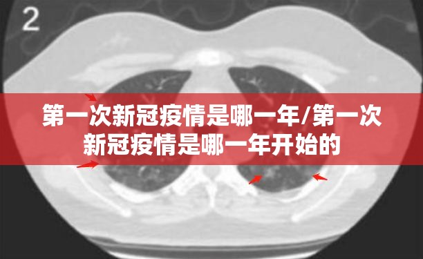 第一次新冠疫情是哪一年/第一次新冠疫情是哪一年开始的