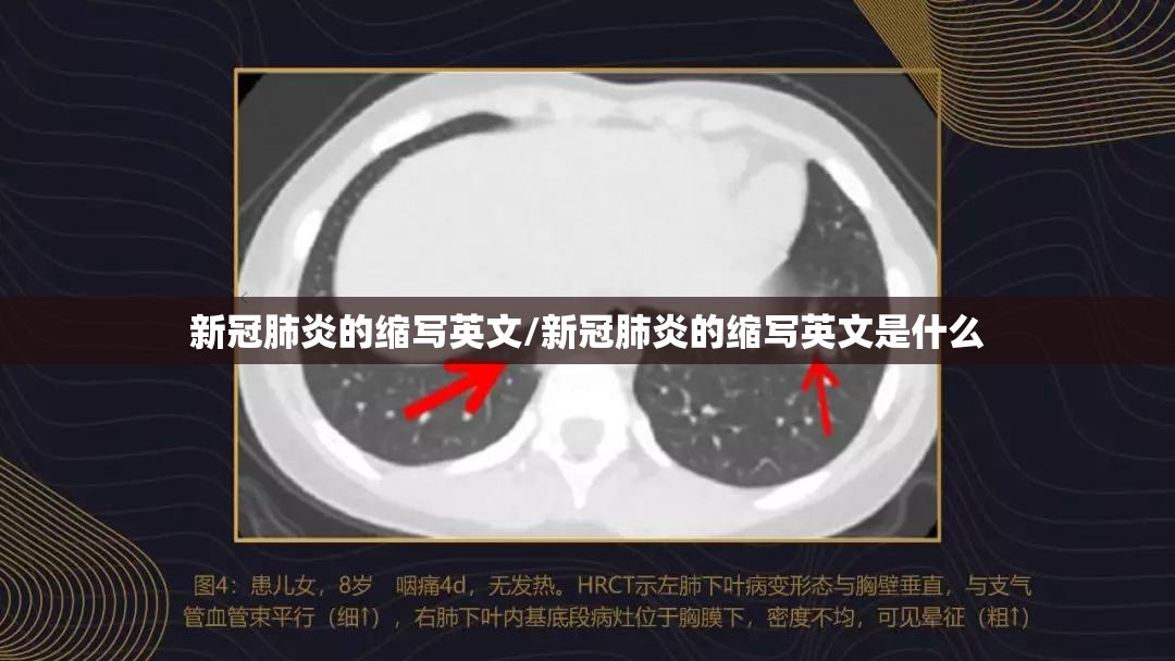 新冠肺炎的缩写英文/新冠肺炎的缩写英文是什么