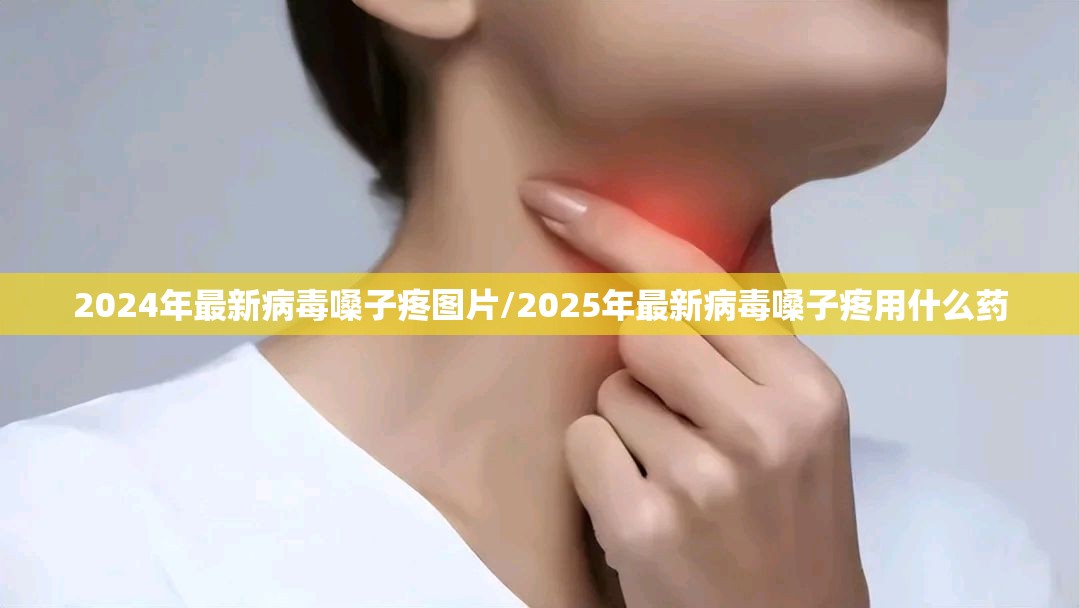 2024年最新病毒嗓子疼图片/2025年最新病毒嗓子疼用什么药