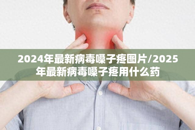 2024年最新病毒嗓子疼图片/2025年最新病毒嗓子疼用什么药