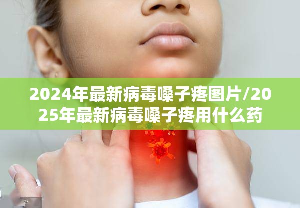 2024年最新病毒嗓子疼图片/2025年最新病毒嗓子疼用什么药