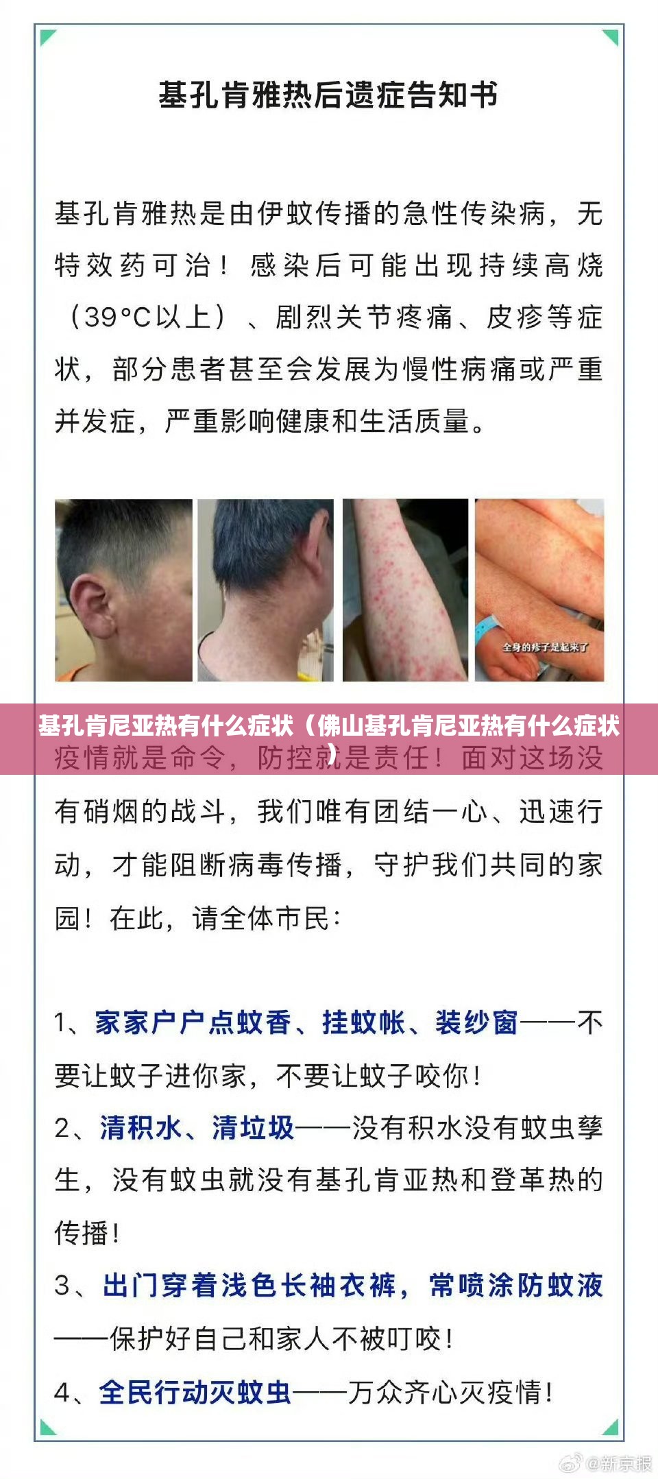 基孔肯尼亚热有什么症状（佛山基孔肯尼亚热有什么症状）