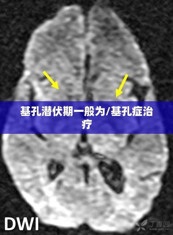 基孔潜伏期一般为/基孔症治疗