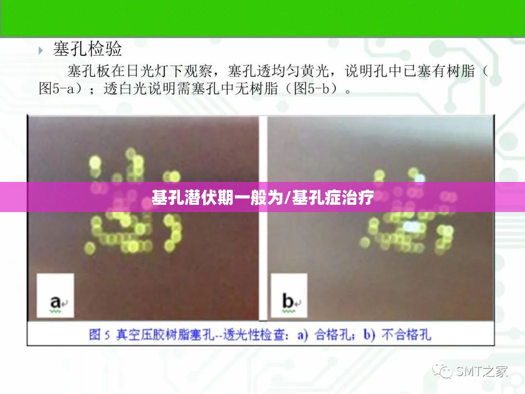 基孔潜伏期一般为/基孔症治疗