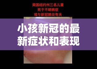 小孩新冠的最新症状和表现:小孩新冠的最新症状和表现有哪些